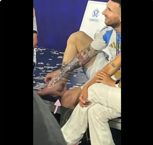 Así quedó el tobillo de Messi tras los festejos del título de la Copa América | FOTO: X (Twitter)