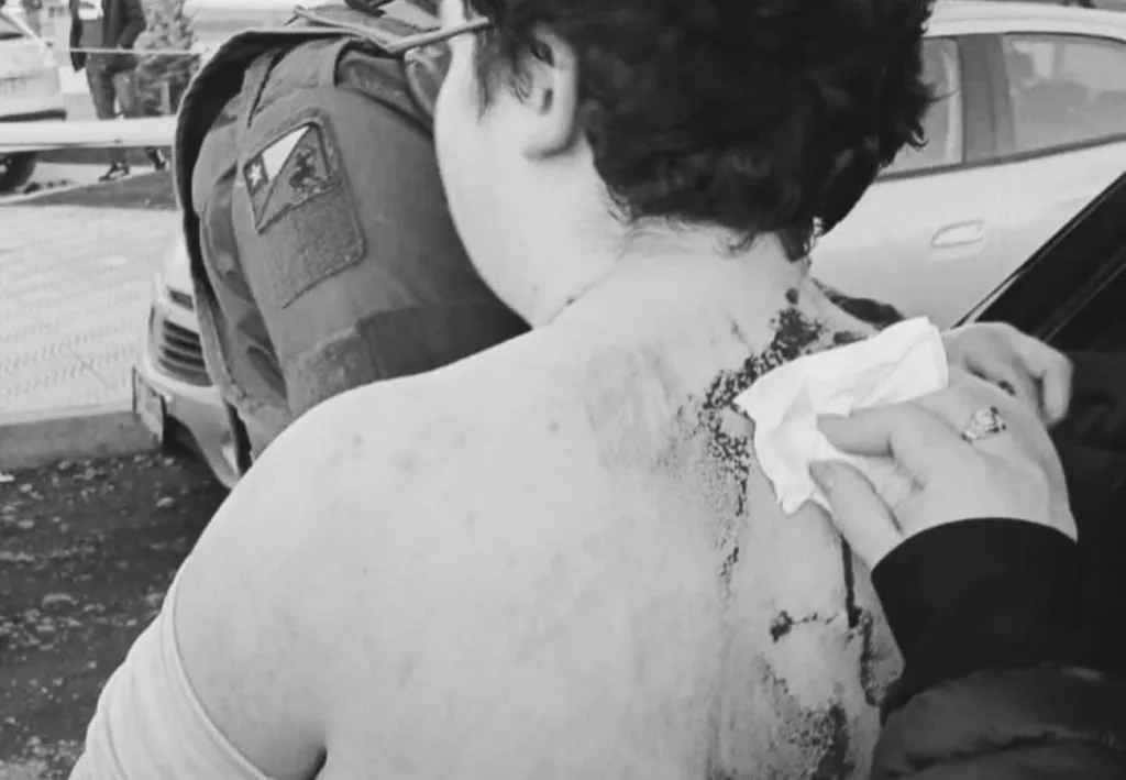 Un menor fue apuñalado en el Naval-Lota. Solo tenía 13 años.