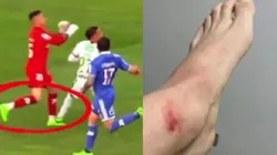 Los detalles de la acción de Campos