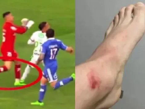 Campos se descarga en Instagram con furioso reclamo en contra del arbitraje