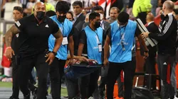 El 'Sicario' Rojas sufrió fractura y no estará ante Colo Colo.