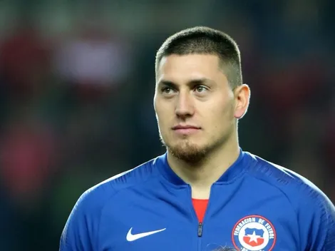 Nicolás Castillo responde a haters que lo trolean por sus lesiones