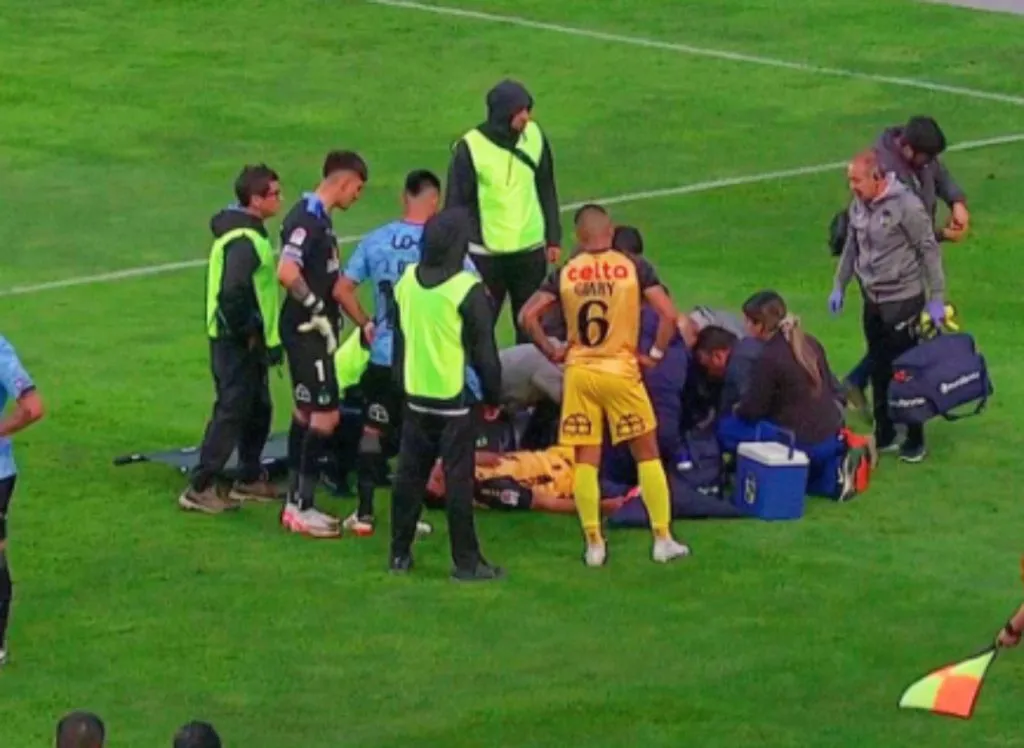 Enzo Mettifogo sufrió una dura fractura en el compromiso entre Coquimbo Unido y O'Higgins. Tiene 18 años.