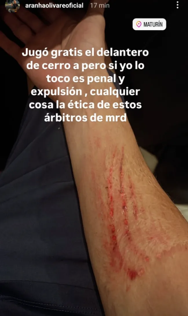 La historia que subió Olivares a su cuenta de Instagram | FOTO: Captura