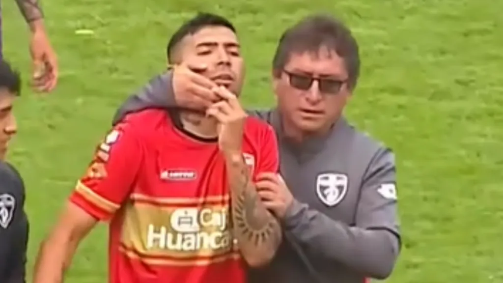  El recordado delantero de Universidad de Chile sufrió un complejo problema en Perú.