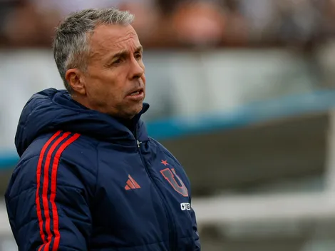 Dolor de cabeza en la U: confirman fecha y hora de los partidos ante Huachipato y Limache