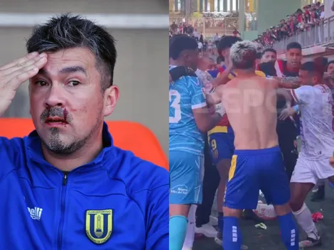 Escándalo: Detienen a jugador de Copiapó por agresión a miembro de UdeC