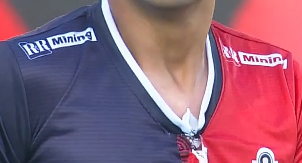 Así lució la camiseta de Ignacio Jara tras ser corcheteada (Foto: captura)