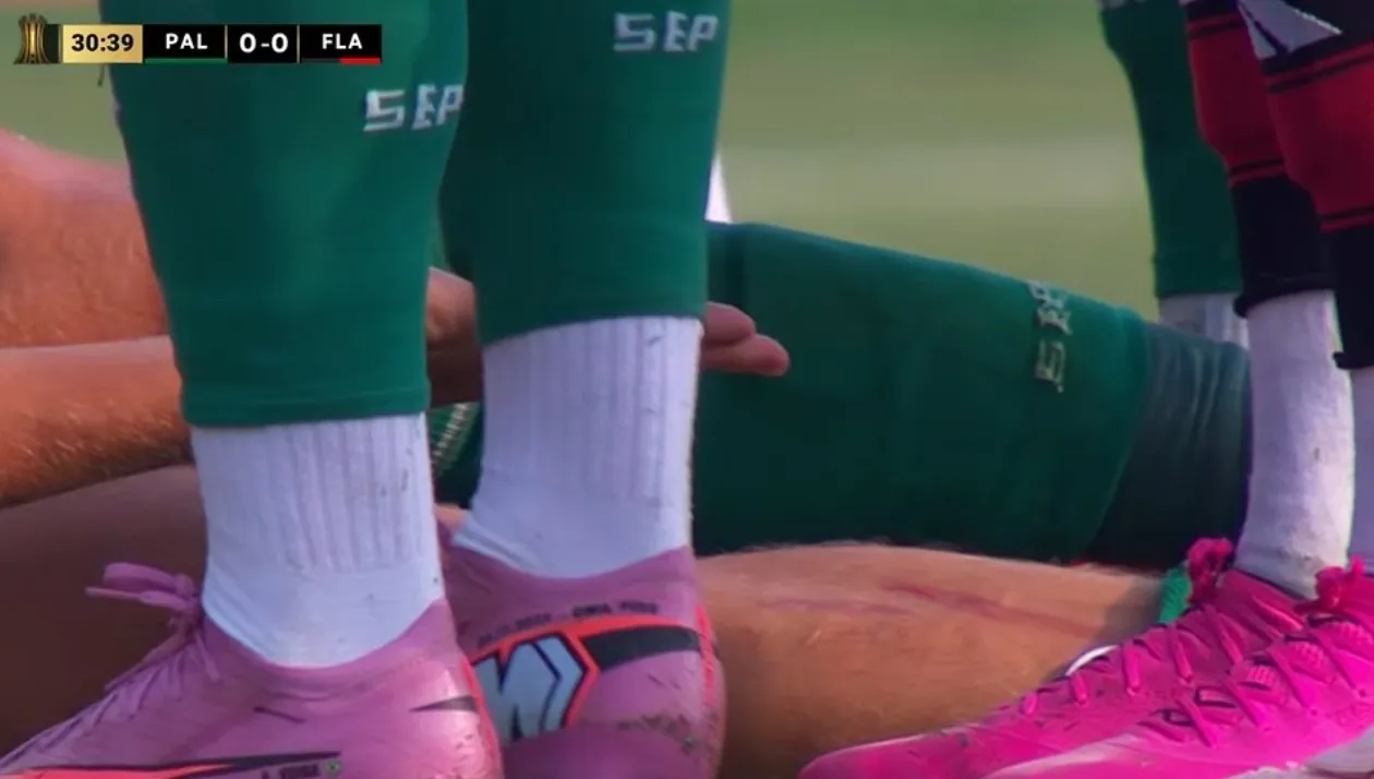 Bruno Fuchs exhibe las consecuencias del planchazo de Erick Pulgar (Captura).