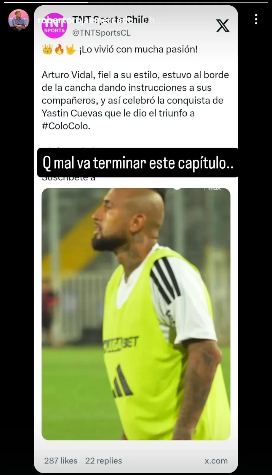 Arturo Vidal fue criticado por el campeón con Universidad de Chile. (Imagen: Photosport)