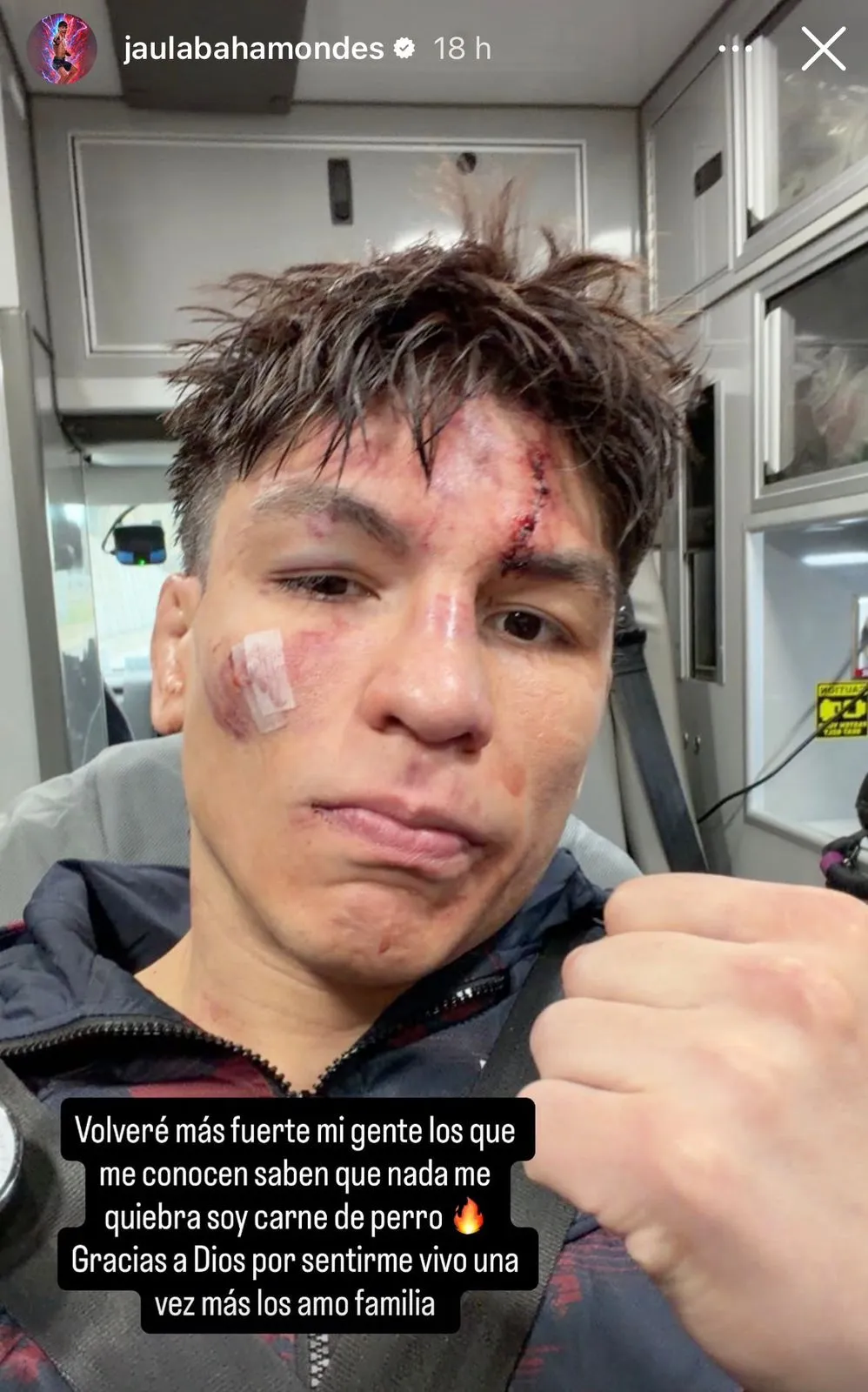 Captura de la historia de Instagram de Ignacio “La Jaula” Bahamondes.