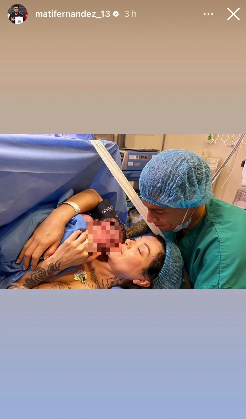 Captura de la historia de Instagram de Matías Fernández.