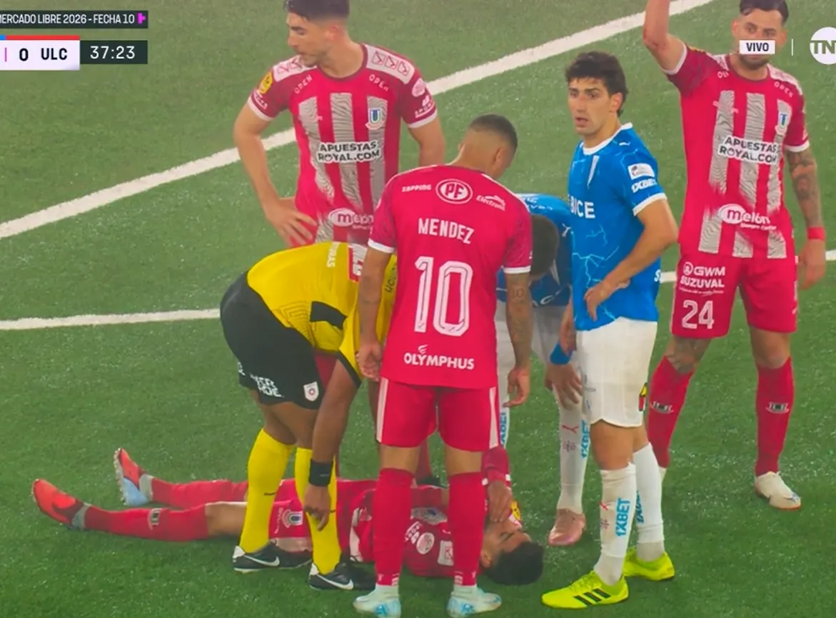 El manotazo de Fernando Zampedri dejó con un corte al jugador calerano (TNT Sports).