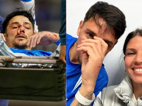 La esposa de Zampedri lleva calma a la UC tras lesión: esto subió a redes