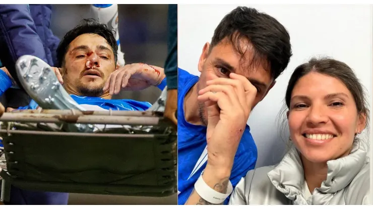 El goleador de Universidad Católica encendió las alarmas.