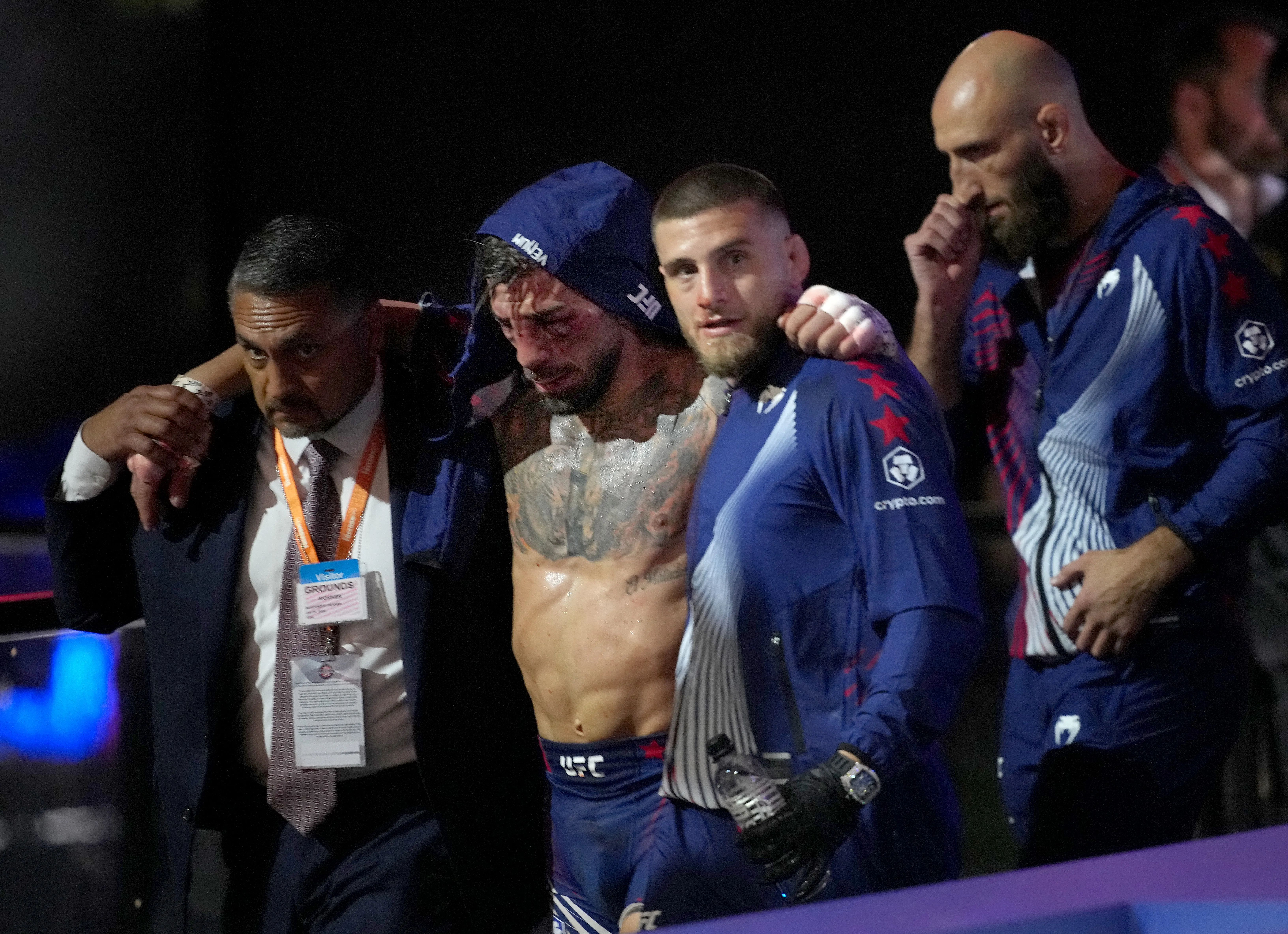 Así quedó el rostro de Ilia Topuria tras finalizado el combate (Photo by Andrew Harnik/Getty Images)