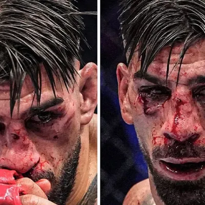 Irreconocible: Así quedó el rostro de Topuria tras la infernal paliza que le dio Gaethje en UFC