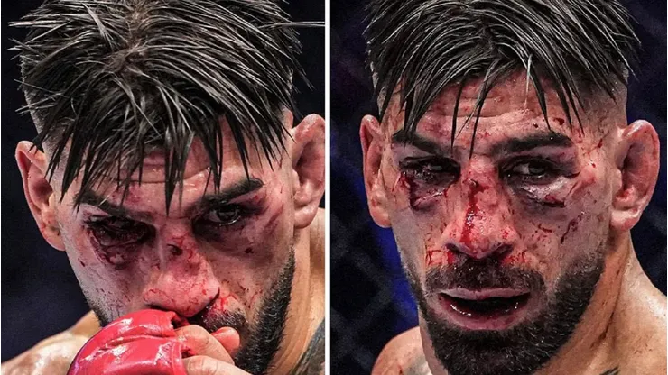 Ilia Topuria no pudo ante un Gaethje que le desfiguró completamente el rostro.