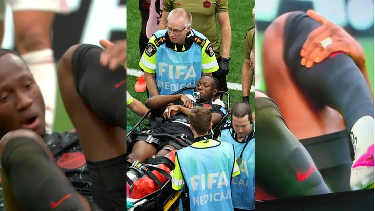 Escalofriantes imágenes dejó la grave lesión de Ismael Koné en Canadá.