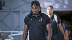 Alberth Elis sufrió un duro golpe en su cabeza