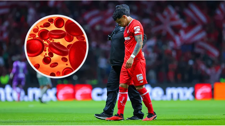 Maxi Araujo padece anemia ferropénica: ¿qué es?