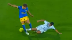 Escalofriante: así quedó la pierna de Igor Lichnovsky tras la dura entrada de Pedro Quispe