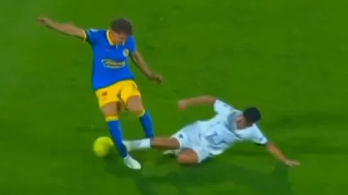 Escalofriante: así quedó la pierna de Igor Lichnovsky tras la dura entrada de Pedro Quispe