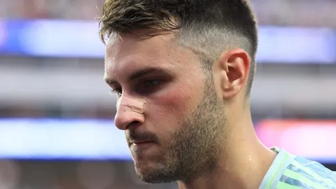 El Chaquito no se salvó de las críticas.