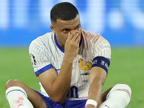 Revelan qué le pasó a Kylian Mbappé en la nariz en Francia vs. Austria