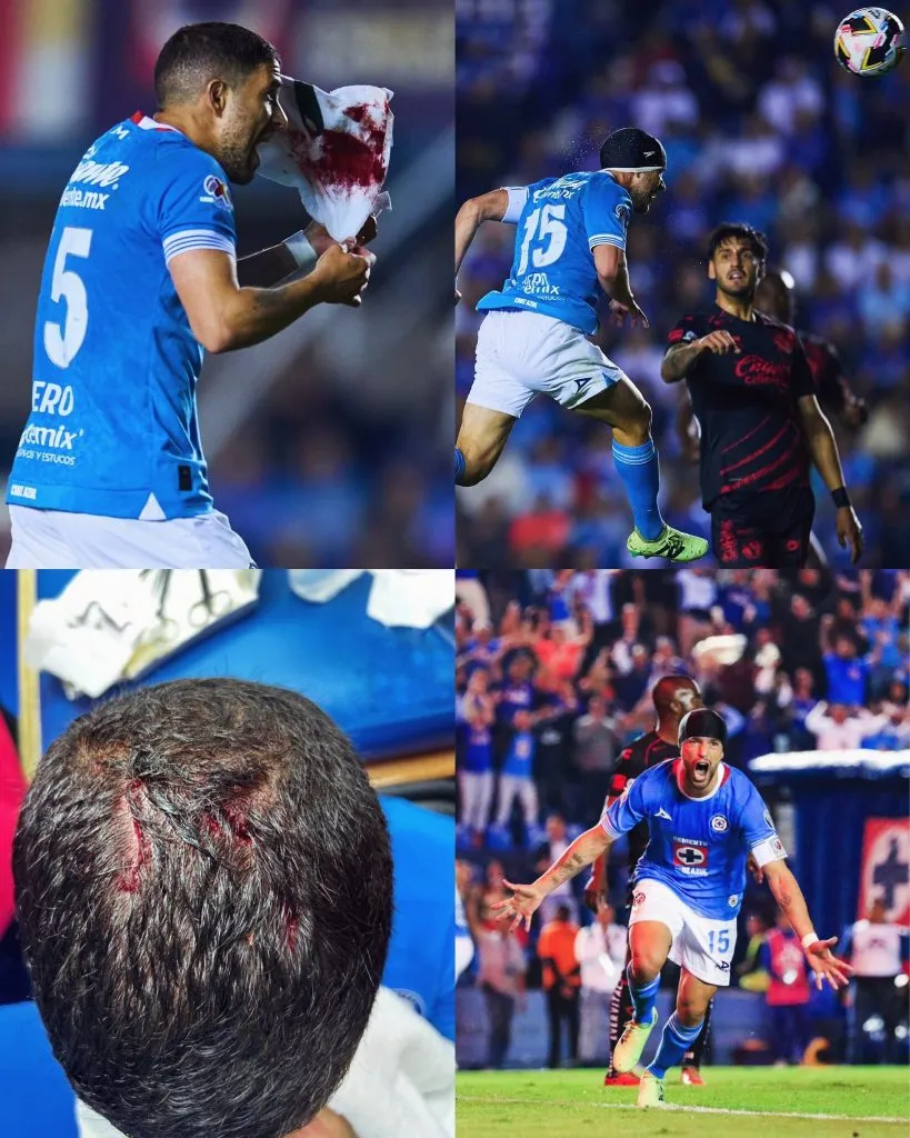 Así quedó la cabeza de Nacho Rivero tras la impactante patada en su cabeza. [Foto Twitter]