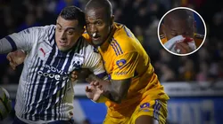 Samir Caetano sangra en el Clásico