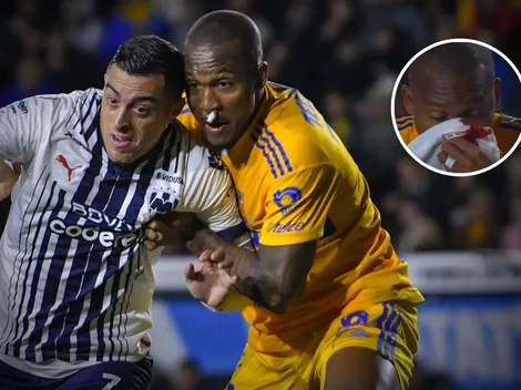 Samir sufre DURO golpe en la nariz que lo deja sangrando