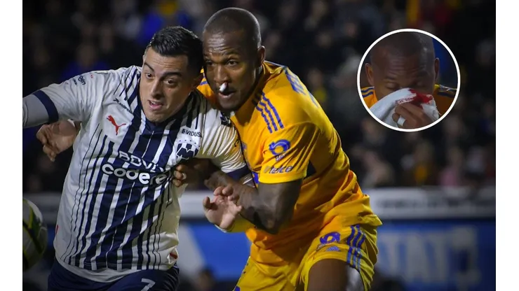 Samir Caetano sangra en el Clásico