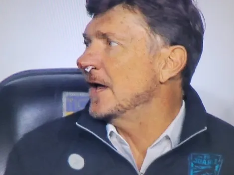 Cristante, sangrando en el banquillo de Juárez vs. Tigres