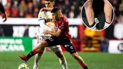 Jesús Angulo recibió cinco faltas ante Tijuana.