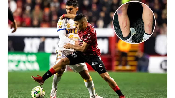 Jesús Angulo recibió cinco faltas ante Tijuana.
