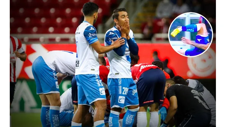 Lesión Gustavo Ferrareis Puebla Apertura 2022