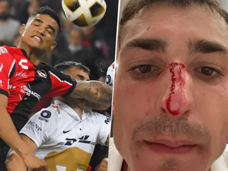 Juan Dinenno y su esposa explotaron contra el arbitraje