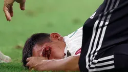 Chucky Lozano apareció en redes tras su lesión.