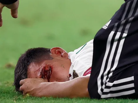 VIDEO: Chucky Lozano apareció en redes tras su temible lesión