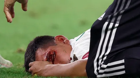 Chucky Lozano apareció en redes tras su lesión.