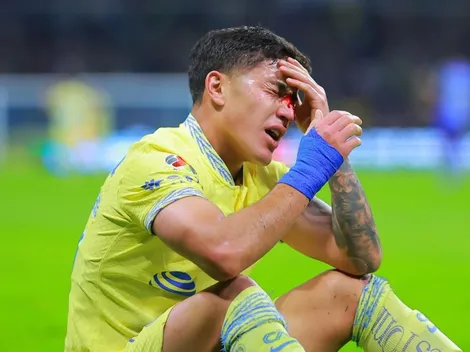 ¿Por qué Alejandro Zendejas jugará con máscara el clásico de América vs. Cruz Azul?