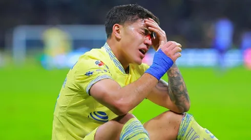 Alejandro Zendejas dispondrá de una máscara en su nariz.