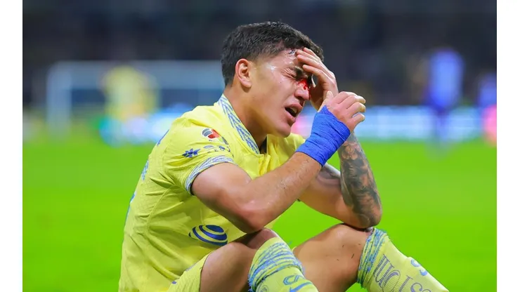 Alejandro Zendejas dispondrá de una máscara en su nariz.