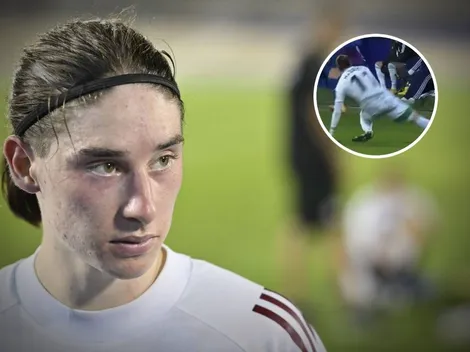 VIDEO | Marcelo Flores salió lesionado con el Real Oviedo