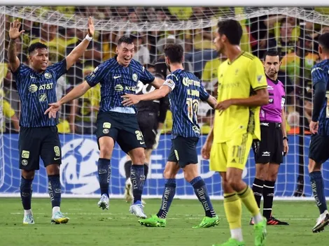 América sufrió la lesión de un jugador en el partido contra Nashville