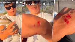 Oscar Valdez fue mordido por uno de sus reptiles