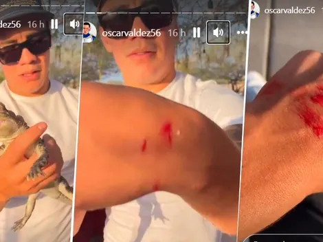 Oscar Valdez fue mordido por uno de sus reptiles