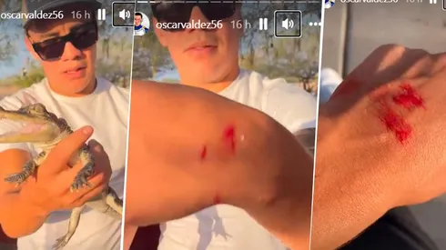 Oscar Valdez fue mordido por uno de sus reptiles