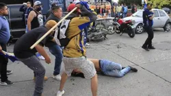 Imágenes sensibles: seguidor del América, brutalmente golpeado en San Luis